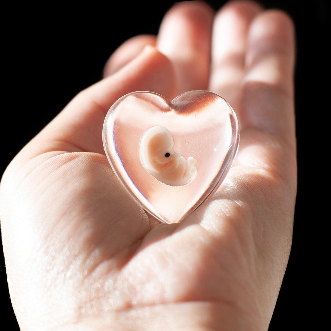 Embryo 7 weeks, 7 weeks pregnant, Sculpture cast in resin - 玩偶/公仔 - 树脂 