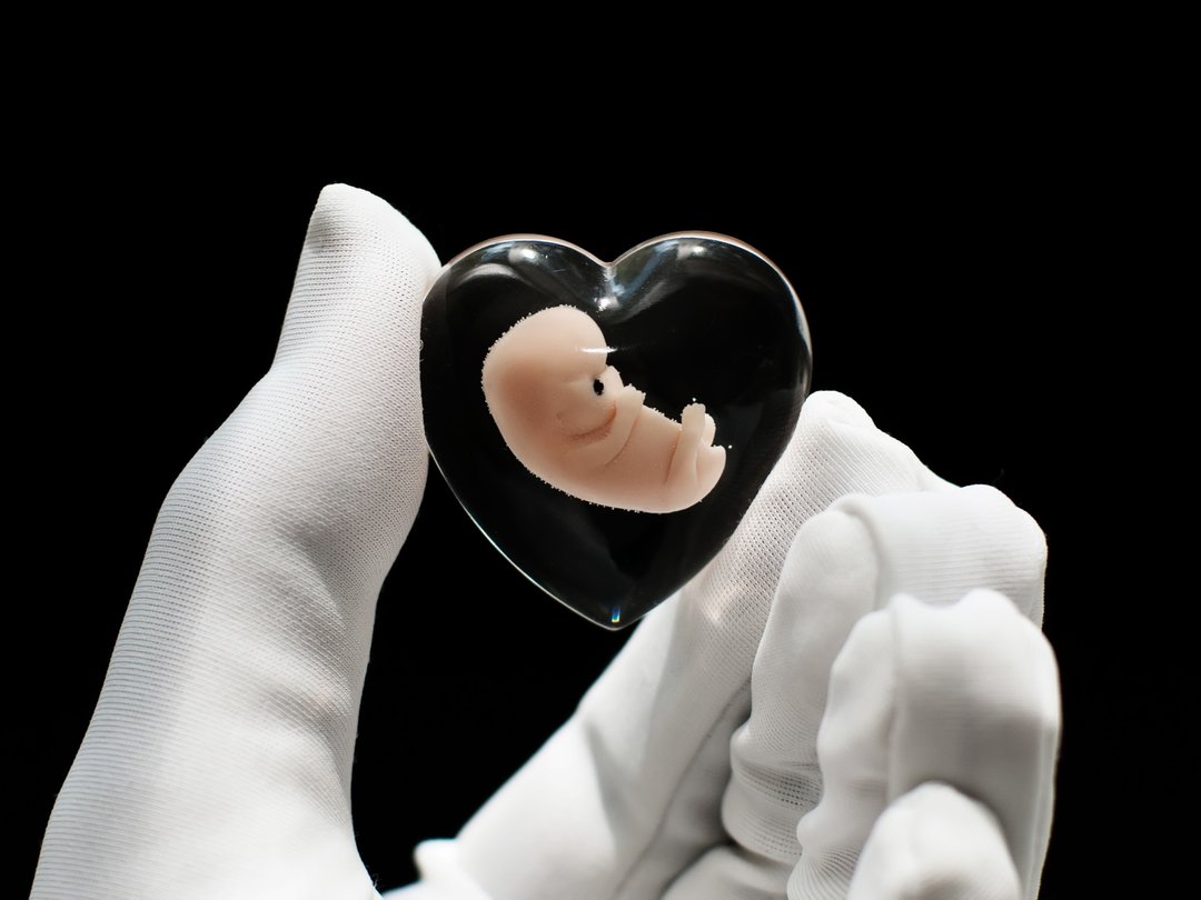 Embryo 8 weeks, 8 weeks pregnant, Sculpture cast in resin - 玩偶/公仔 - 树脂 