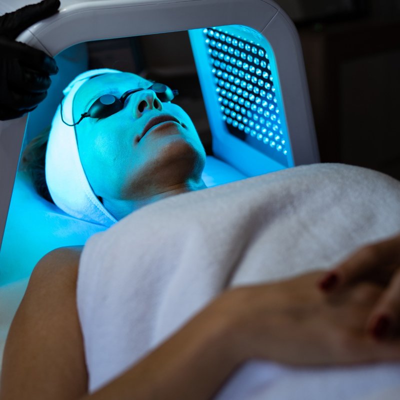 PDT嫩肤光效护理|男女适用|高雄做脸|高雄美容 - 蜡烛/香氛 - 其他材质 